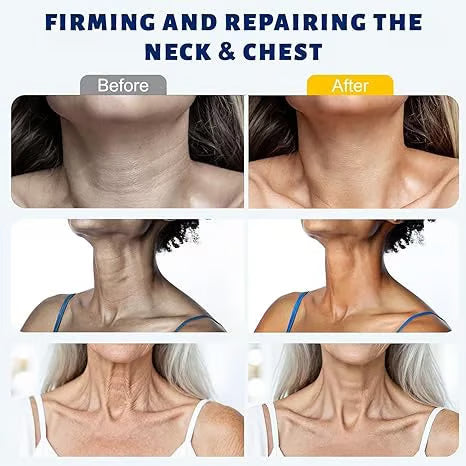 Rolimey® Neck Firming Roller Cream 🪄| Collagen & Hyaluronic Acid Anti-Ageing Cream for Wrinkles, Sagging Skin & Double Chin