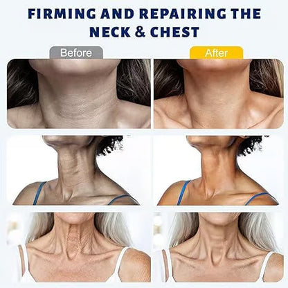 Rolimey® Neck Firming Roller Cream 🪄| Collagen & Hyaluronic Acid Anti-Ageing Cream for Wrinkles, Sagging Skin & Double Chin